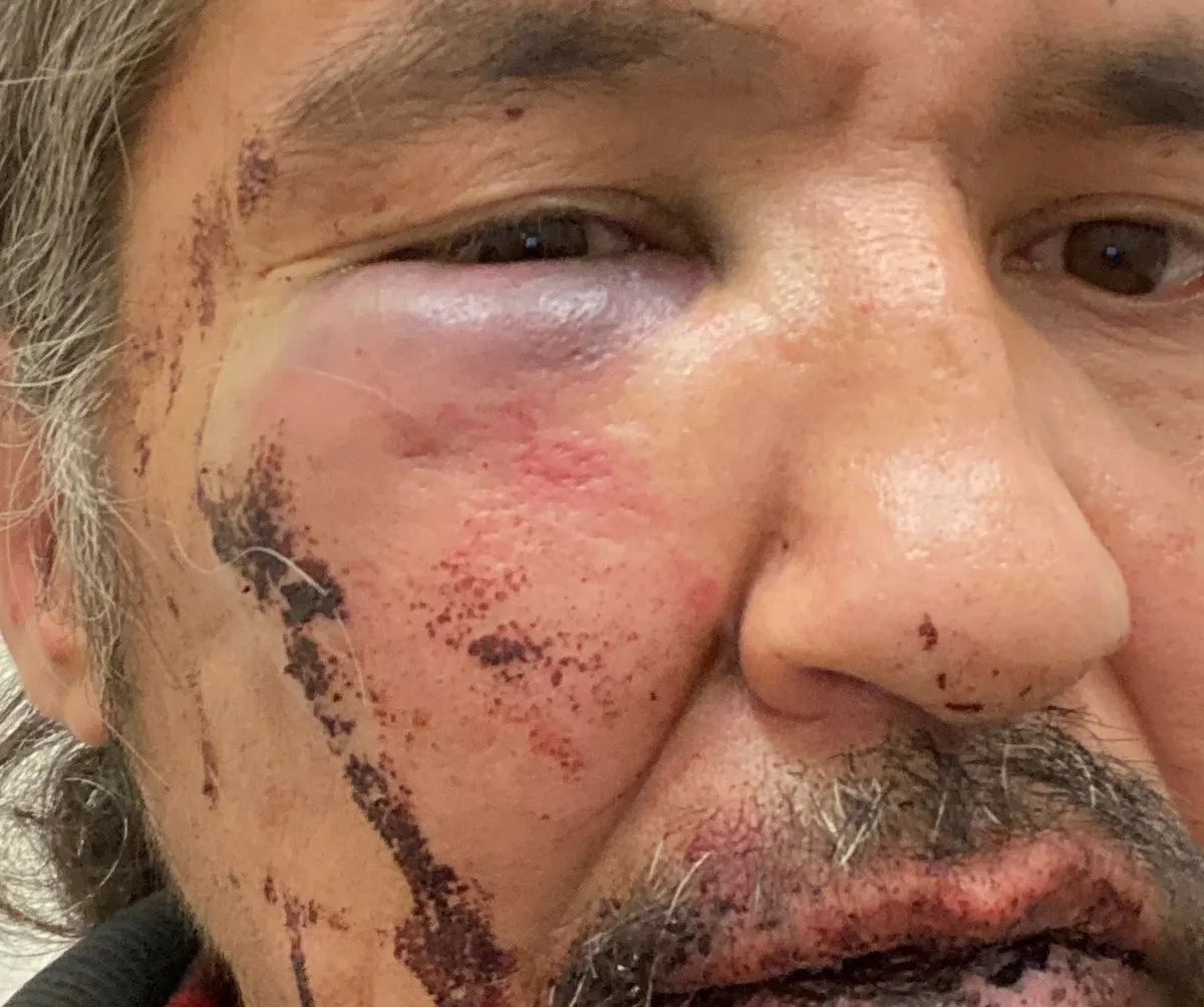 Dashcam Footage Shows Police Chokehold on Athabasca Chipewyan Chief in Alberta Casino Parking Lot